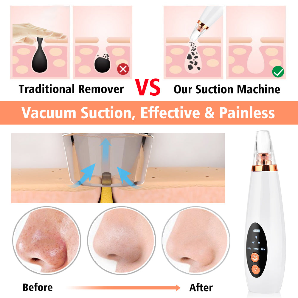 Electronic Professional Skin Face Deep Nose Pore Pore Cleaner Vaccum microdermabrasion Blackhead Suction Remover